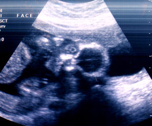 Racial Outcomes in Maternal Mortality